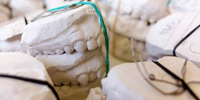 Affordable Dentures Implants Brooklyn 11229: Understanding Snap-on Dentures