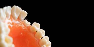 Affordable Dentures Locations Brooklyn: Understanding The Types of Dentures Offered