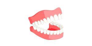 Professional Same Day Dentures Near Me Brooklyn 11229: Myths About Dentures
