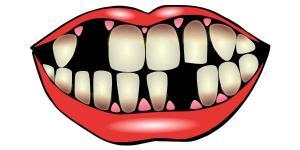 Quality Affordable Dentures Brooklyn 11229 Services: Denture Relines and Why They Are Necessary