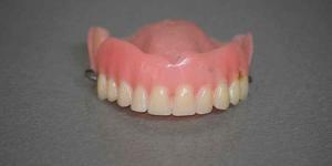 Quality Cheap Dentures Brooklyn: Secrets to Help You Save Money on Your Next Dentures