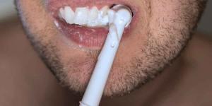 Dentist Brooklyn Tips: Application of Laser in Dentistry