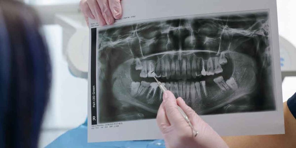 Same Day Dentist Near Me: Importance of Dental Health